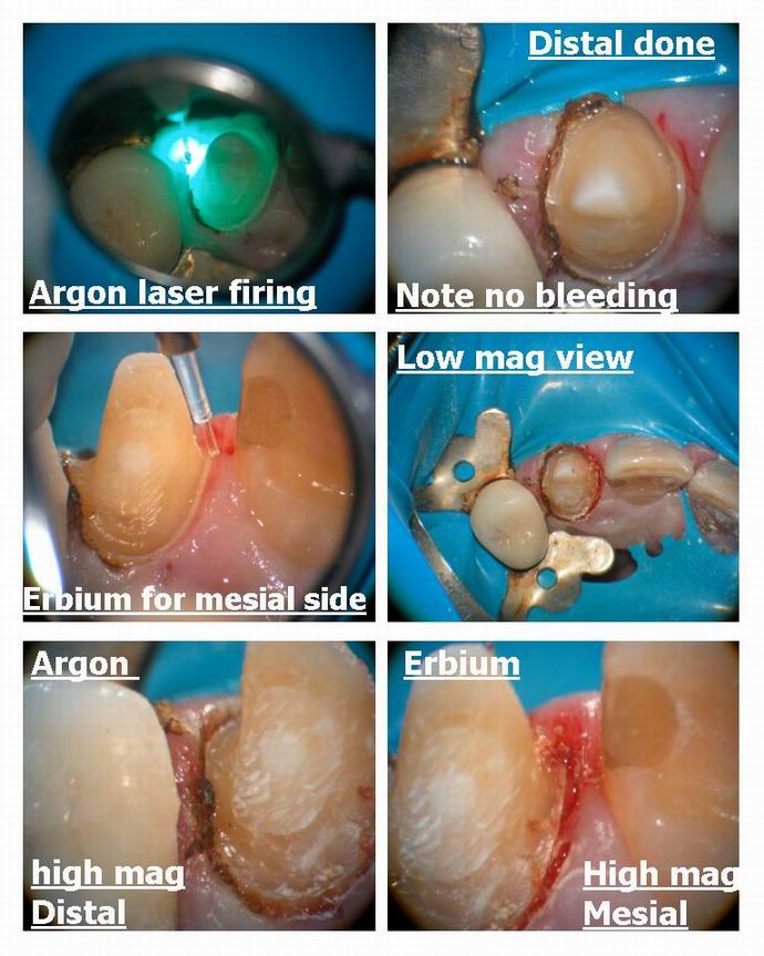 Hard tissue vs soft tissue pg 2.jpg